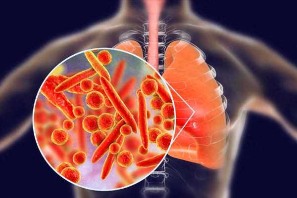 为什么今年支原体传染严重?肺炎支原体的传播途径