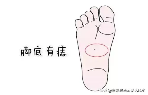 脚下有痣代表什么命运?女人脚下有痣啥意思