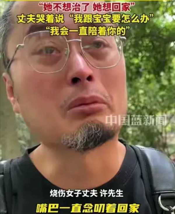 被烧伤女子为治疗剃头发 丈夫也剃头